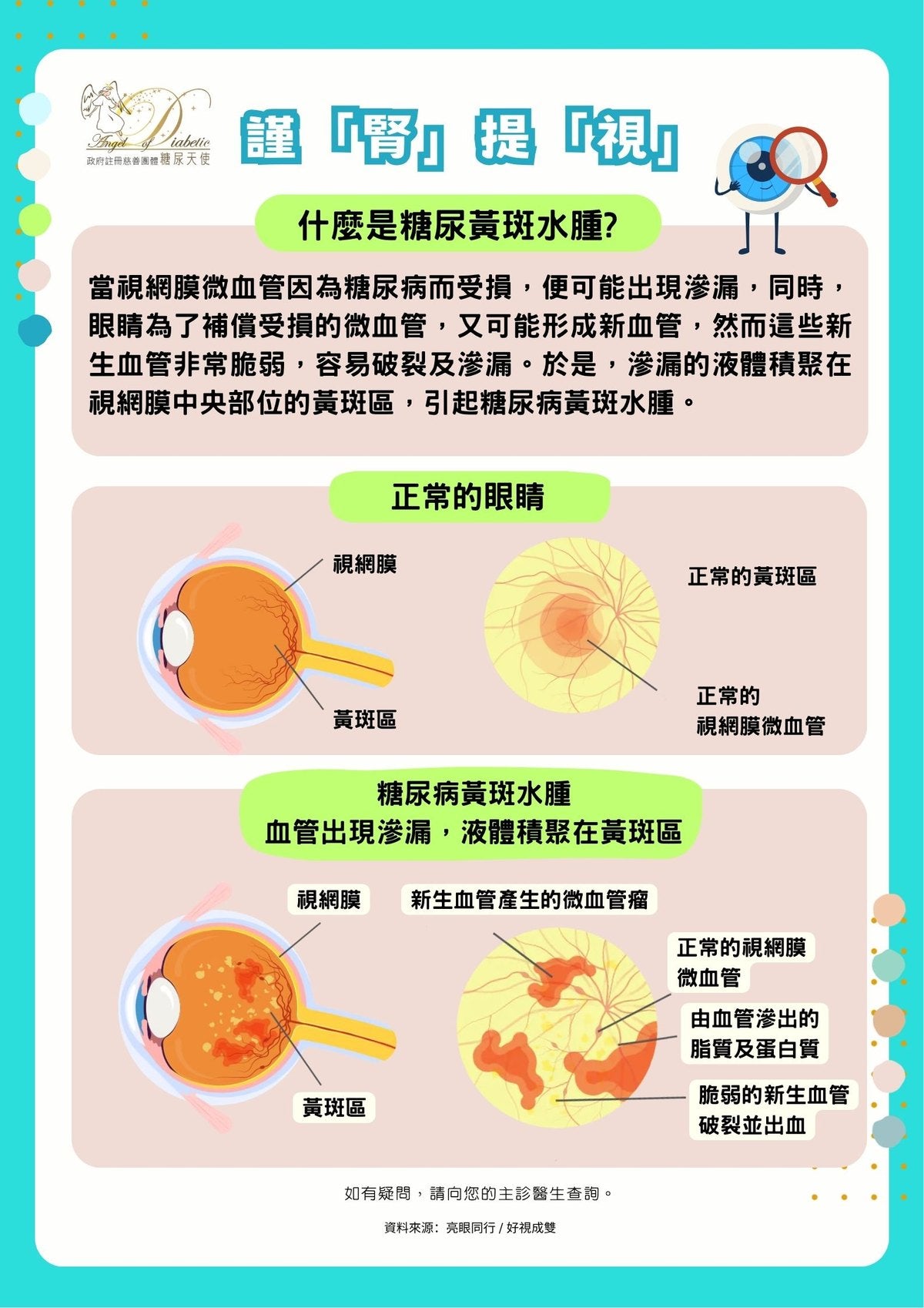 謹「腎」提「視」資訊圖：甚麼是糖尿病黃斑水腫（DME）